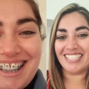 Ortodoncia y Ortopedia