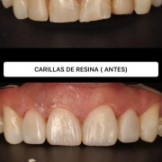 Estética y Armonización Orofacial / Odontología Wellness e Integrativa