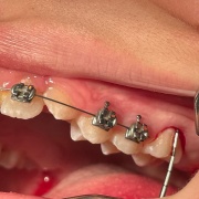 Periodoncia, Implantología y Rehabilitación Oral (PIRO)