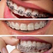 Ortodoncia y Ortopedia