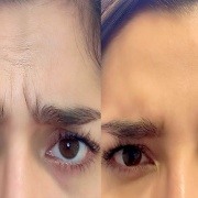 Estética y Armonización Orofacial / Odontología Wellness e Integrativa