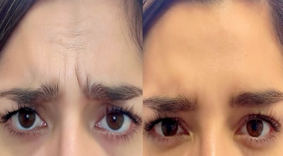 Estética y Armonización Orofacial / Odontología Wellness e Integrativa