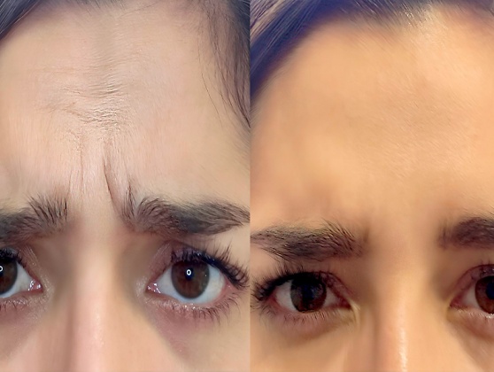 Estética y Armonización Orofacial / Odontología Wellness e Integrativa