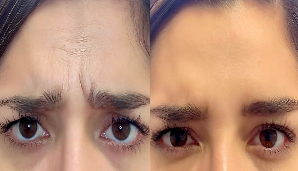 Estética y Armonización Orofacial / Odontología Wellness e Integrativa